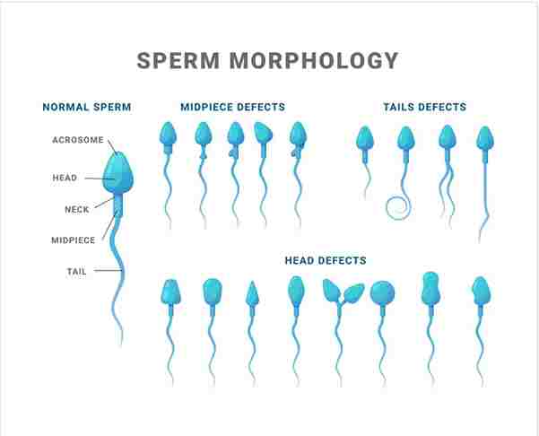 What is sperm   How long does sperm live outside the body  How long can sperm survive  how long does sperm live in the body 
